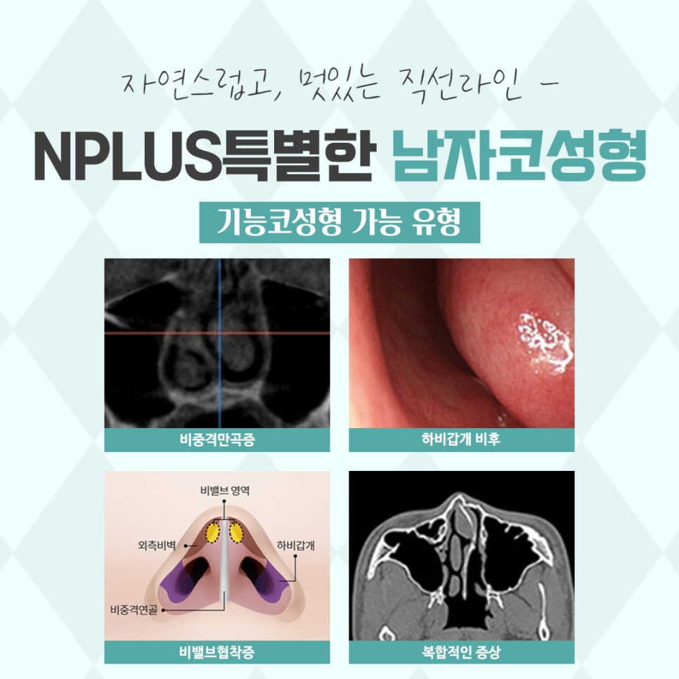 Looking into Male Rhinoplasty, Including Function image 5