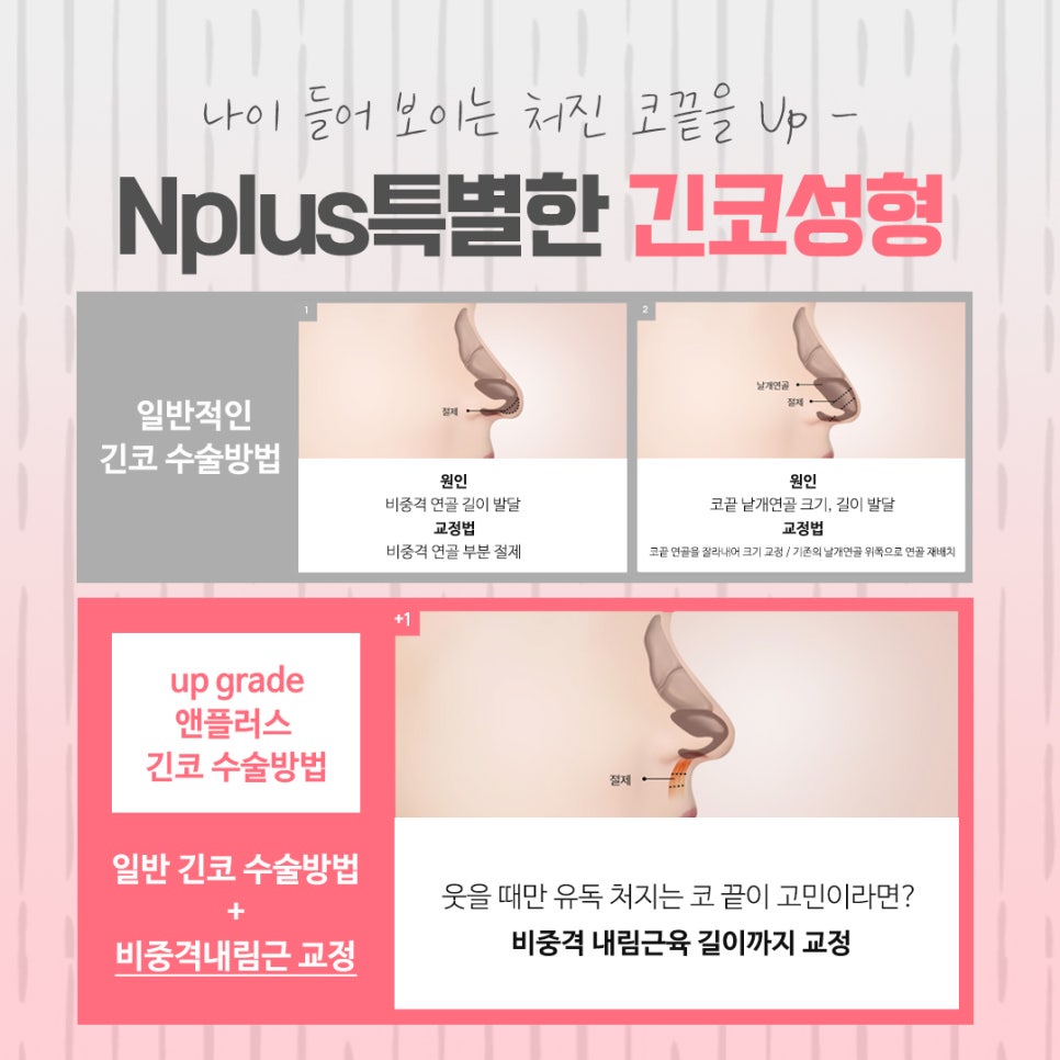 긴코성형 자연스럽게 교정하여 관련 이미지 6