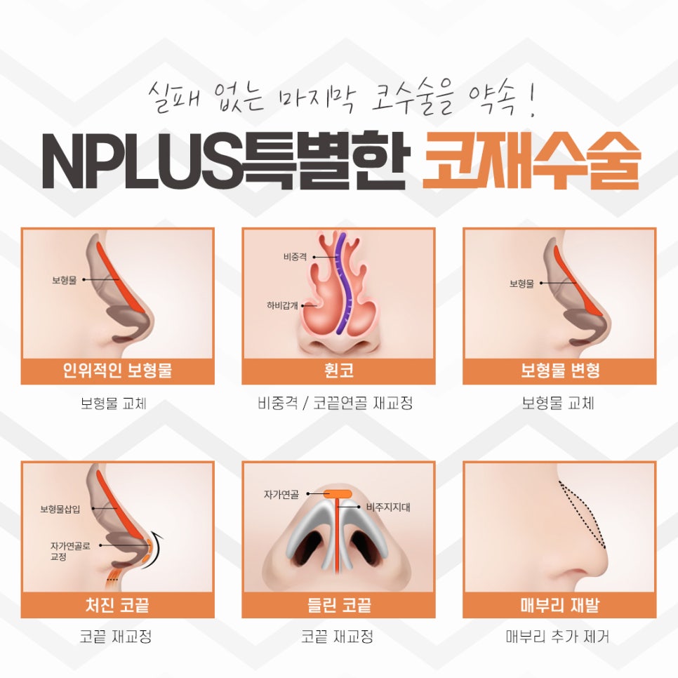 The Importance of Choosing a Revision Rhinoplasty Review image 9