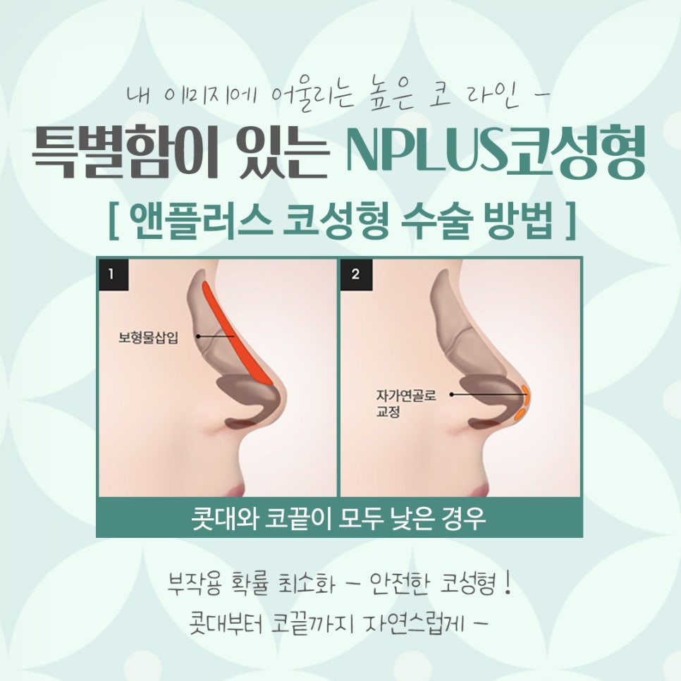 코수술잘하는곳 신중하게 선택 관련 이미지 8