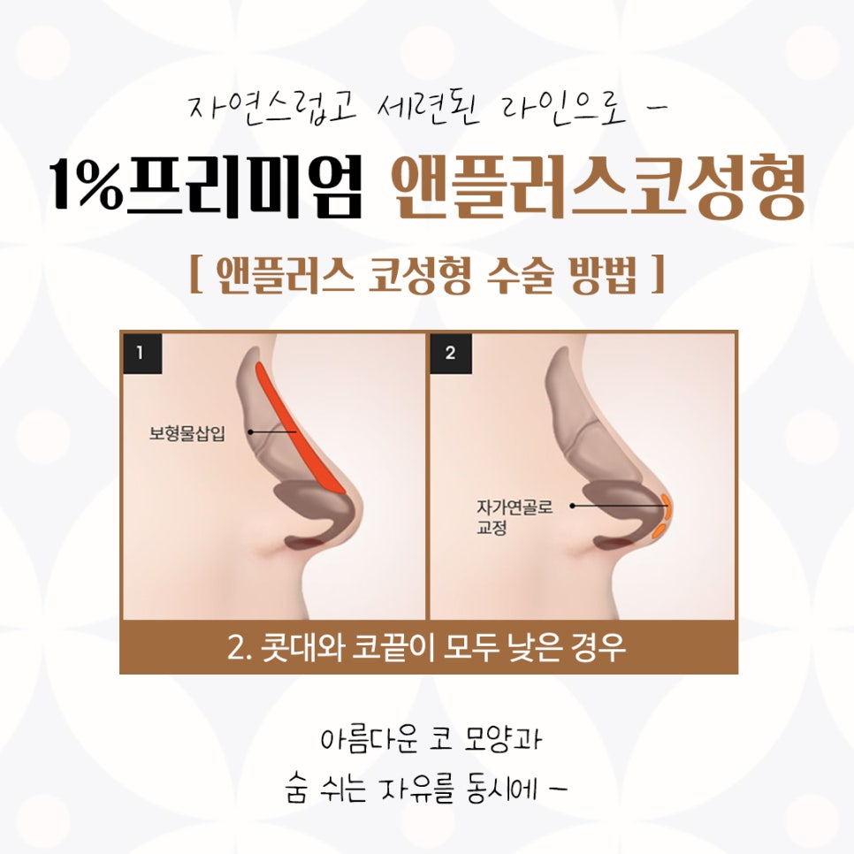 자가늑연골코수술에 대한 내용을 찾는다면 관련 이미지 10