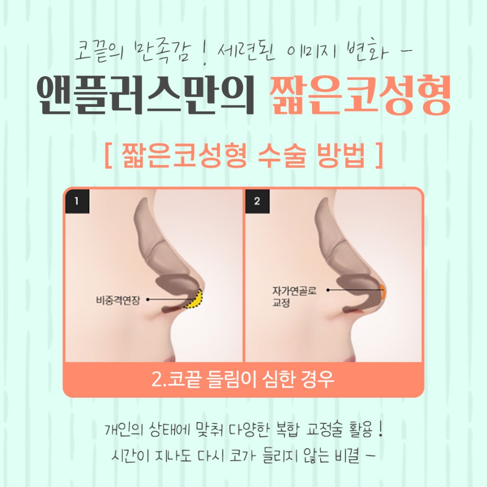 Short Nose Surgery with an Accurate Diagnosis image 10