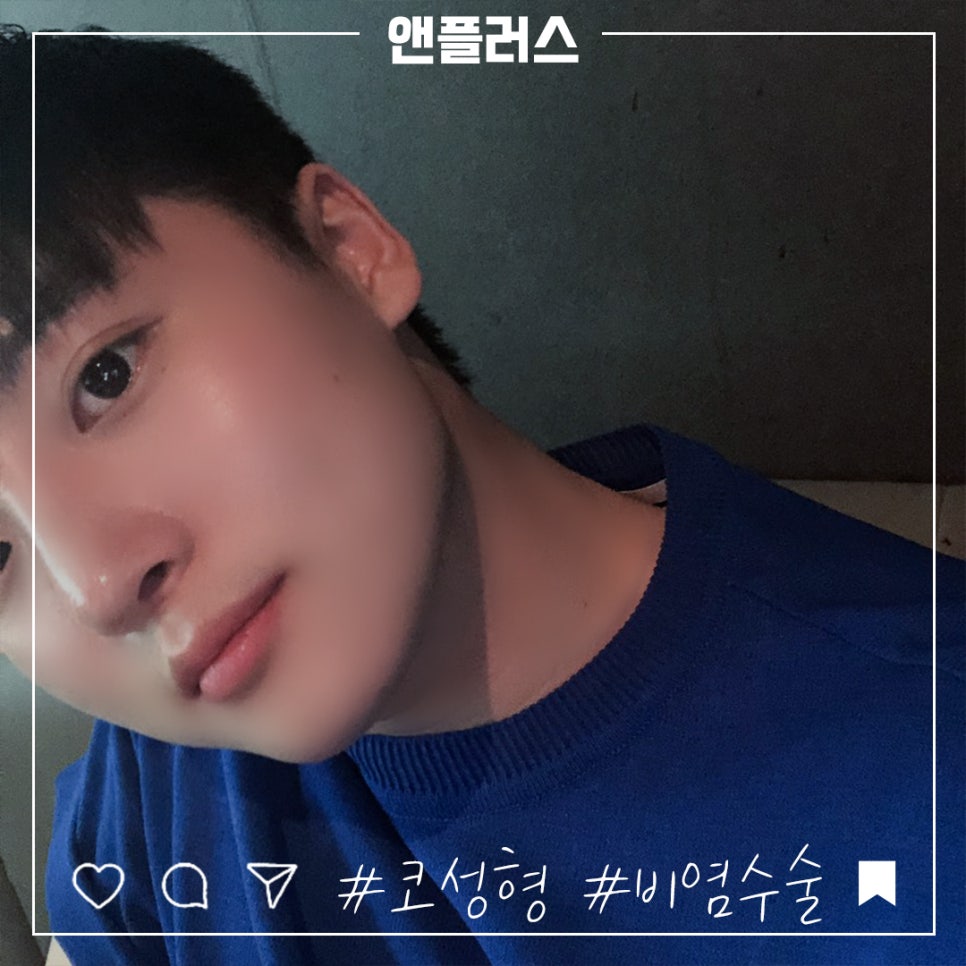 비염수술코성형 동시에 개선이 가능 관련 이미지 1
