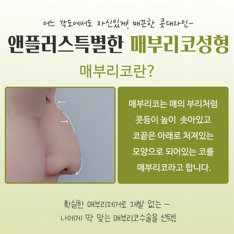 매부리코수술후기 다양한 이미지를 확인하고 관련 이미지 3