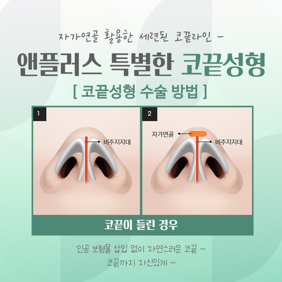 코끝성형후기를 확인하고 자연스럽게 교정하여 관련 이미지 8