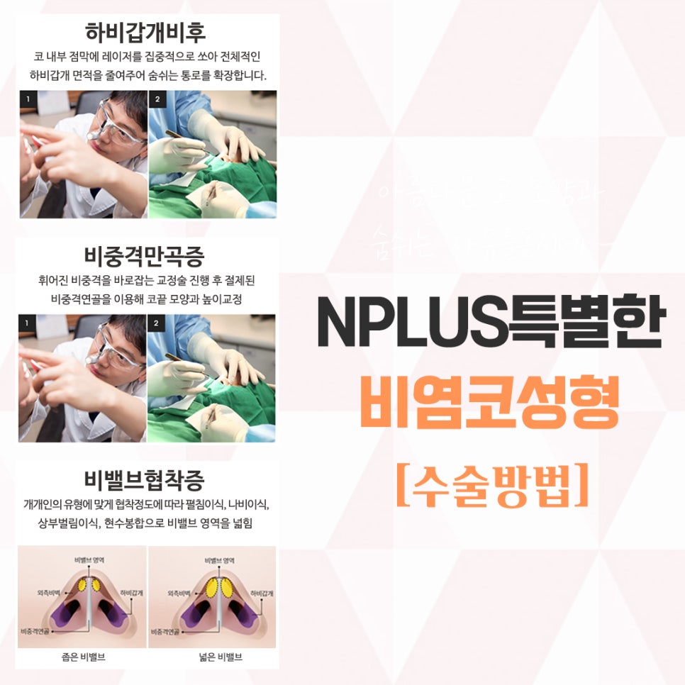 비염의원인과 해결 방법에 대해 관련 이미지 8