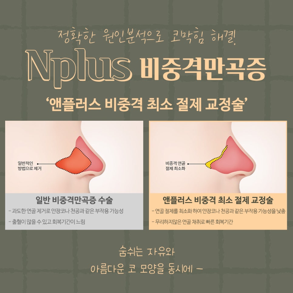 Septoplasty Surgery Explained at Gangnam Nose Surgery image 11
