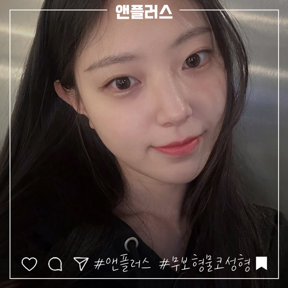 무보형물코성형후기 만족스러운 라인으로 관련 이미지 2