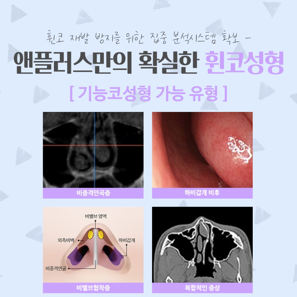 Taking a Thorough Look at Functional Deviated Nose Surgery image 6