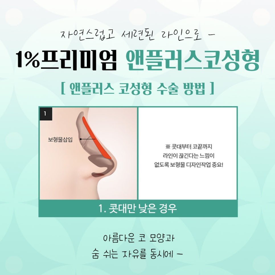 늑연골코성형에 대해 자세히 알아보고 관련 이미지 8