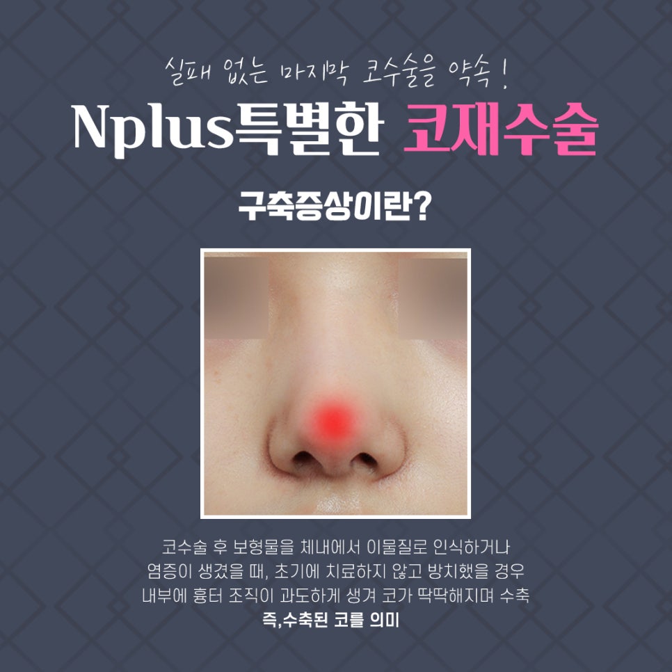 구축코재수술후기 증상부터 확실하게 치료 관련 이미지 5