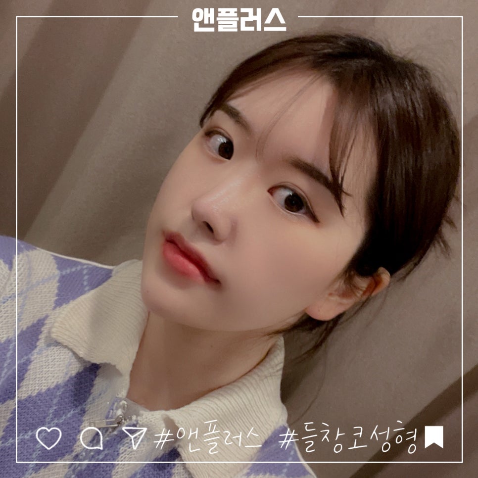 짧은코수술 후기까지 확실하게 관련 이미지 1