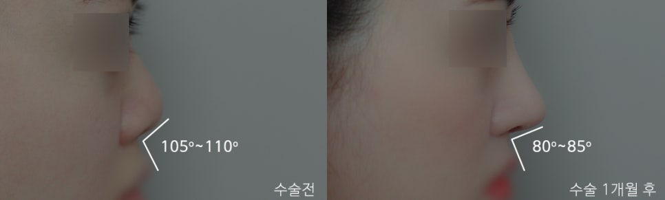 What Is the Prettiest Nose That Suits My Face Best? image 3