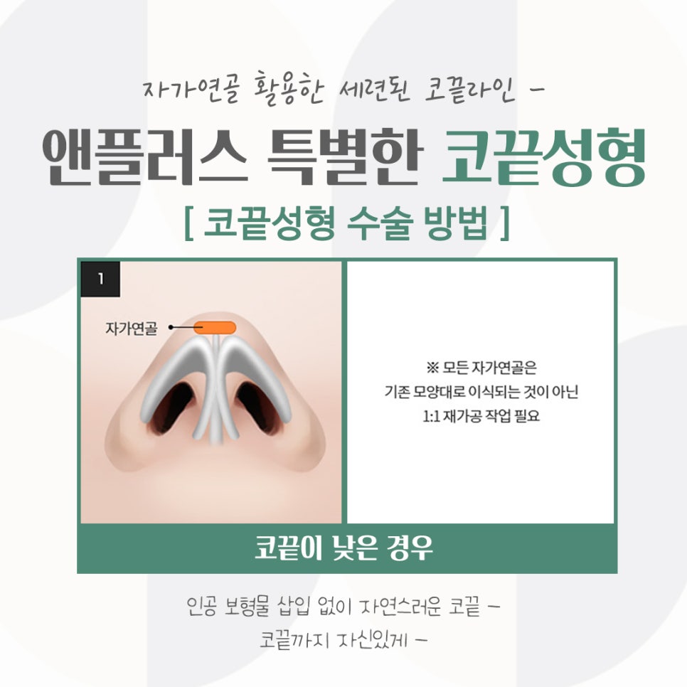 코끝연골묶기로 자연스러운 코라인 관련 이미지 7