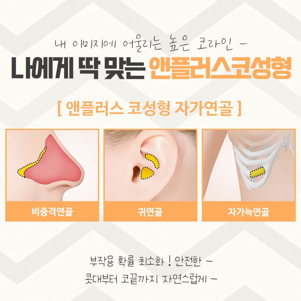 코수술후기에 대해 자세하게 알아보고 관련 이미지 11