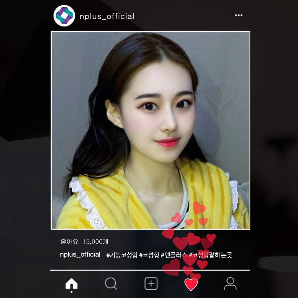 기능코성형후기 꼼꼼하게 알아보고 관련 이미지 2