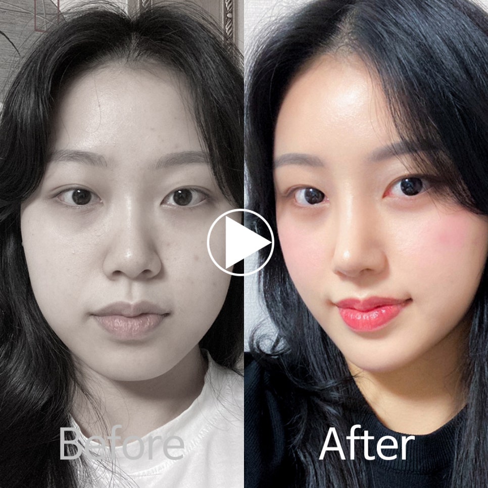 🎀앤플러스 코성형 모델모집🎀 관련 이미지 3