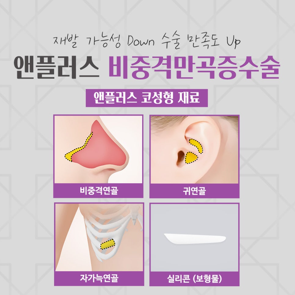 비중격만곡증수술 원인을 자세하게 관련 이미지 10