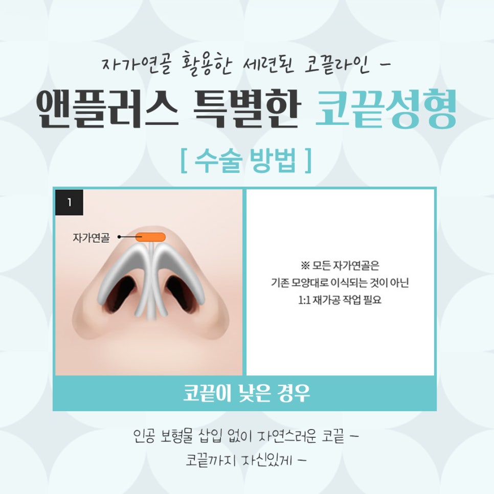 Looking Into Tip Rhinoplasty Reviews and a Natural-Looking Image image 7