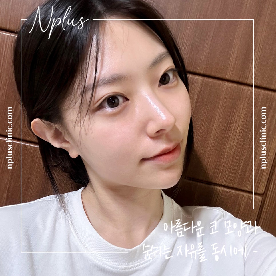 Looking at the Differences in Nose Tip Surgery Reviews image 1