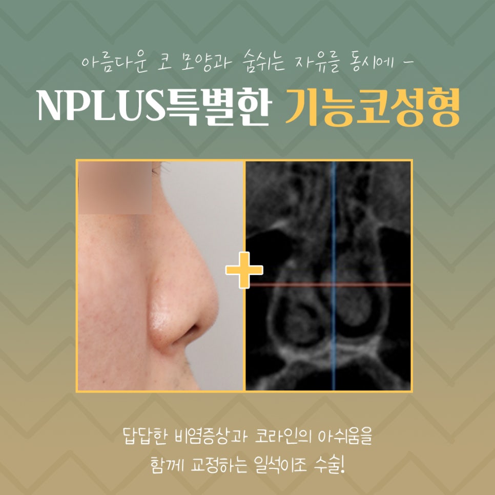 Making an Accurate Judgment About Functional Rhinoplasty Reviews image 5