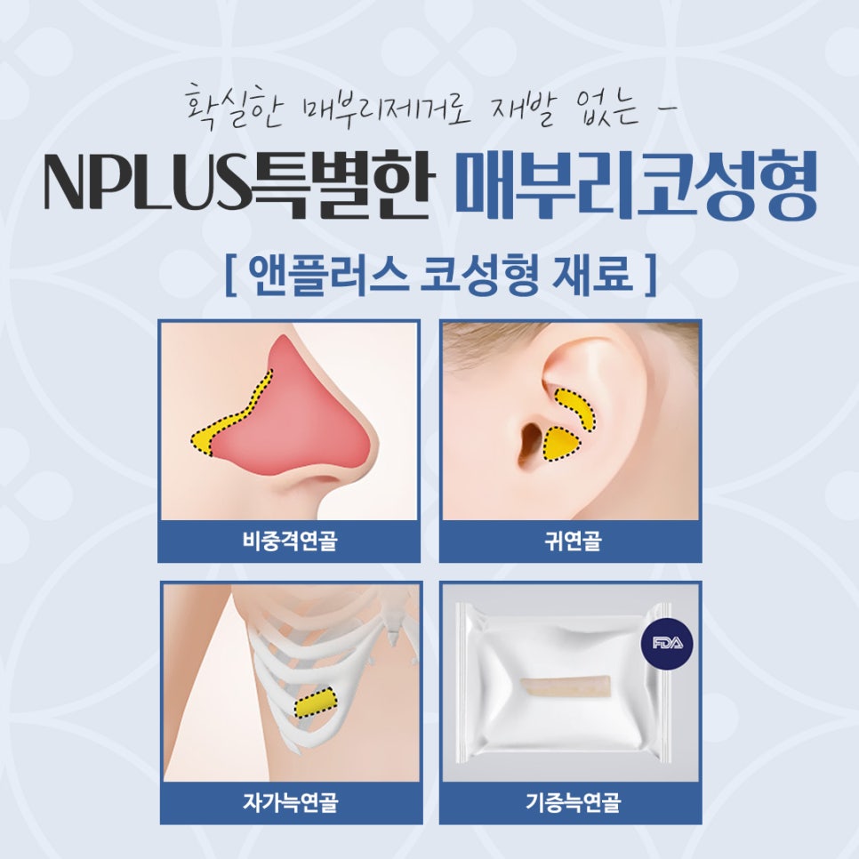 Hump Nose Surgery Review with an Accurate Diagnosis image 12