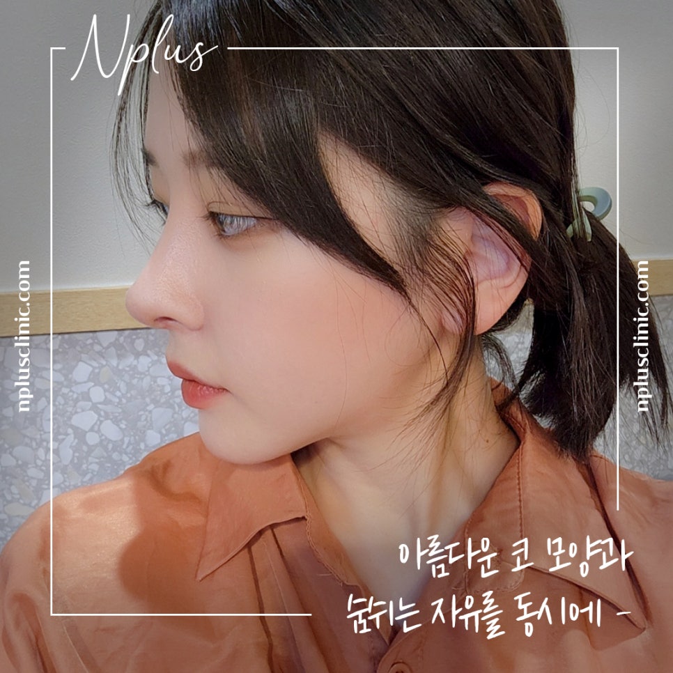 코끝수술후기 다양한 정보를 알아보고 관련 이미지 1