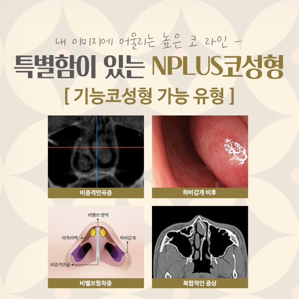 코수술병원을 꼼꼼하게 체크하여 관련 이미지 6