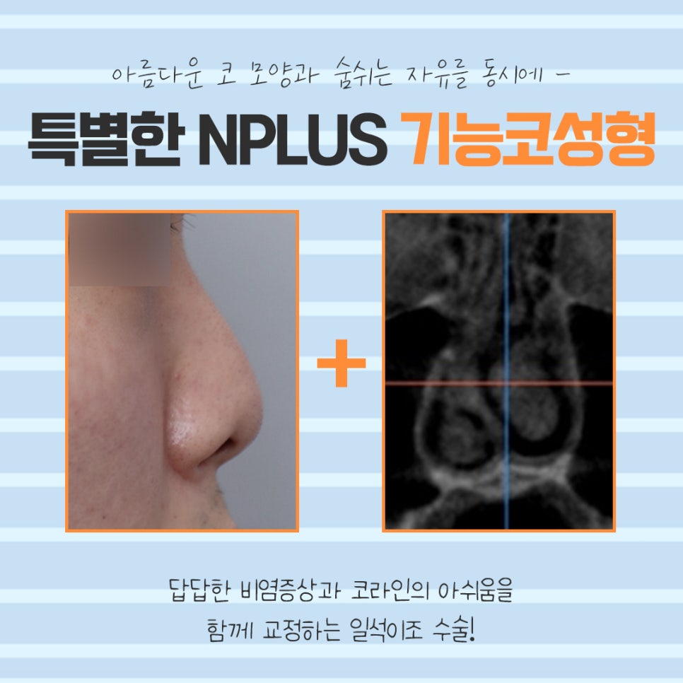 기능코수술실비 확실하게 알아보고 관련 이미지 12