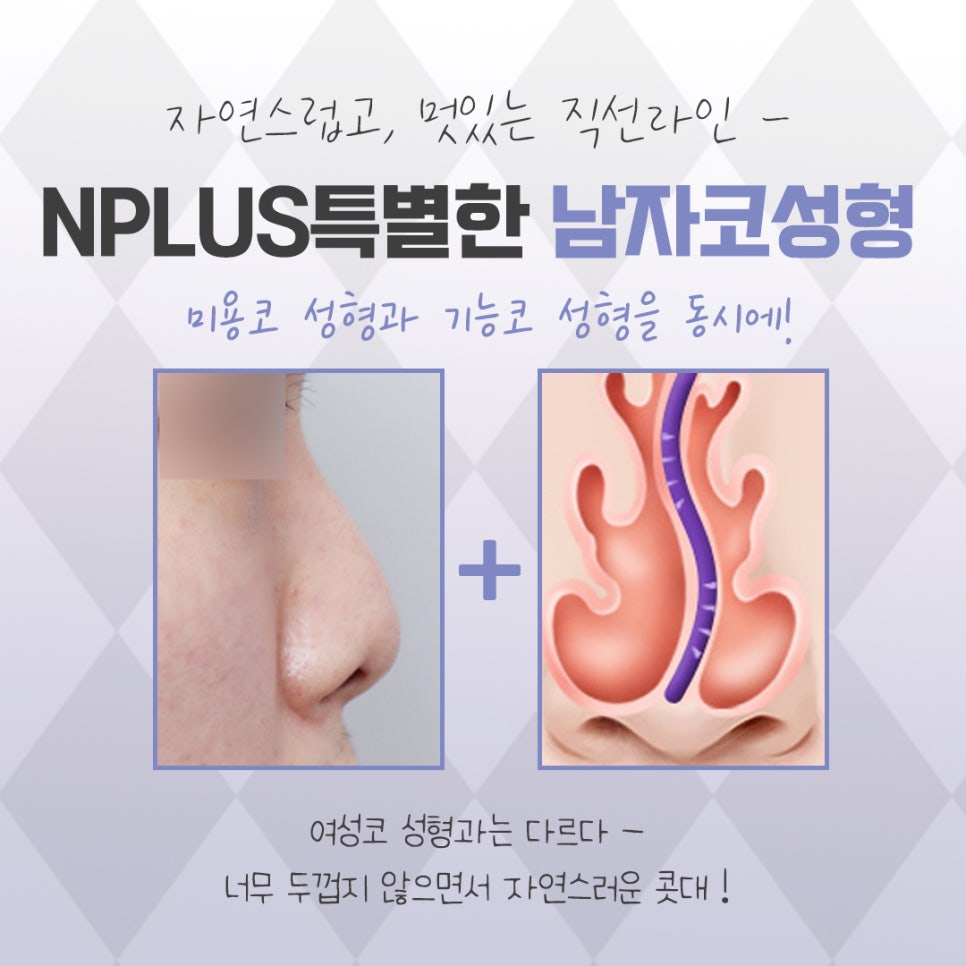 Looking Closely at Before-and-After Male Nose Surgery image 4
