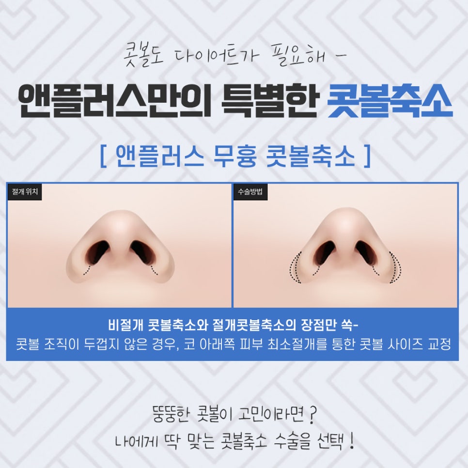 콧볼축소수술 확실한 교정으로 관련 이미지 8