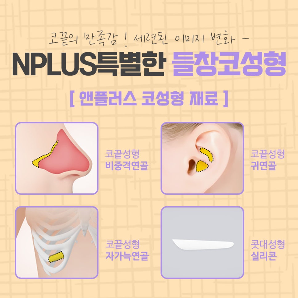 들창코성형 후기까지 알아보고 관련 이미지 11