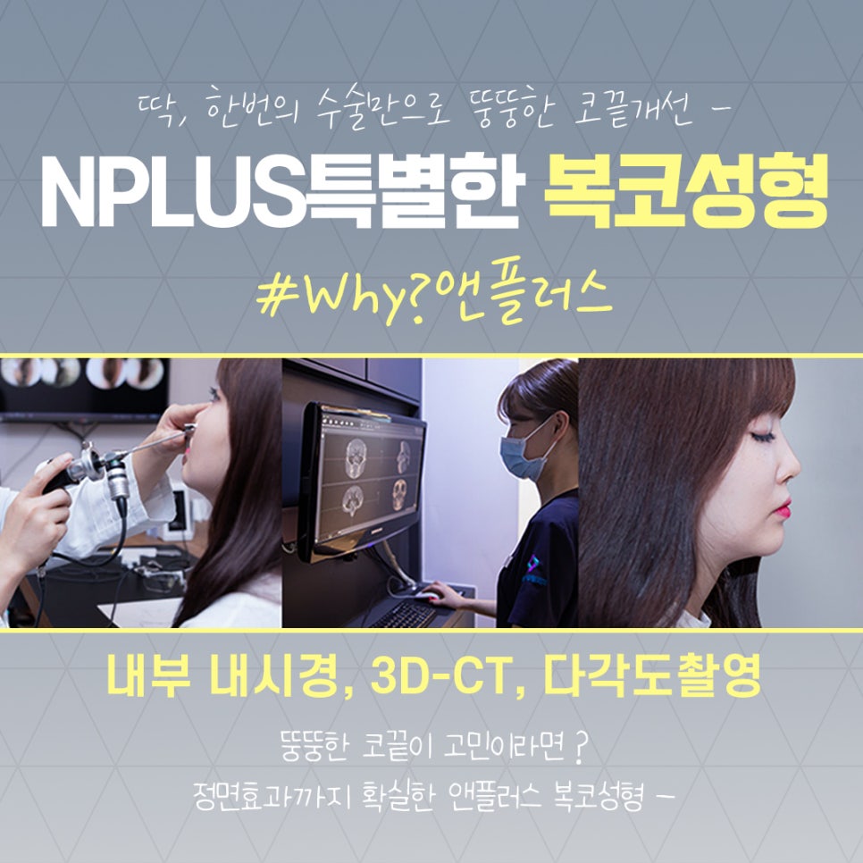 복코수술후기 조화로운 얼굴 라인 관련 이미지 4