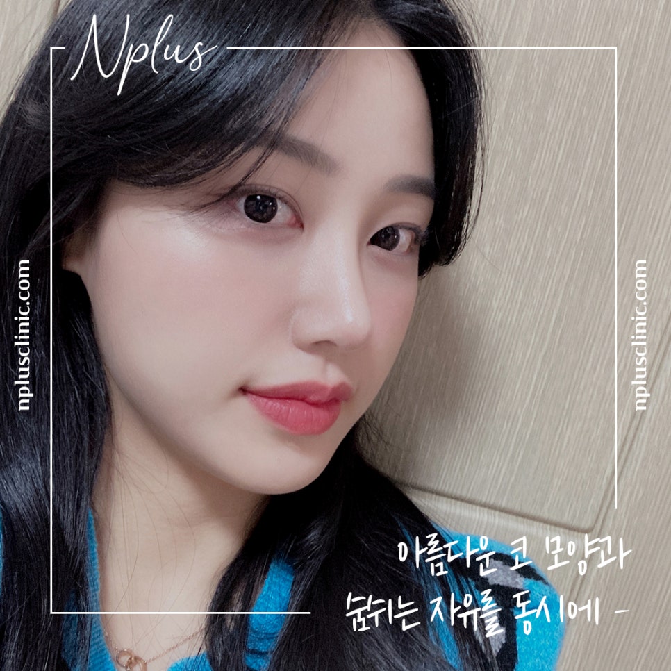 코성형실비를 알아보고 결정 관련 이미지 10