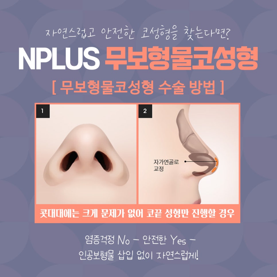 무보형물코수술 자연스러운 코 라인을 원한다면! 관련 이미지 9