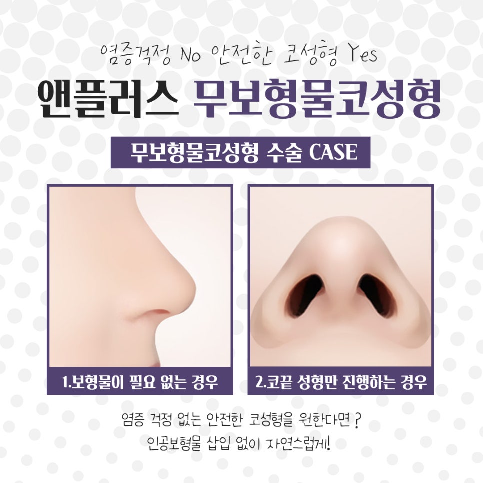 Accurately Check Non-Implant Rhinoplasty image 7
