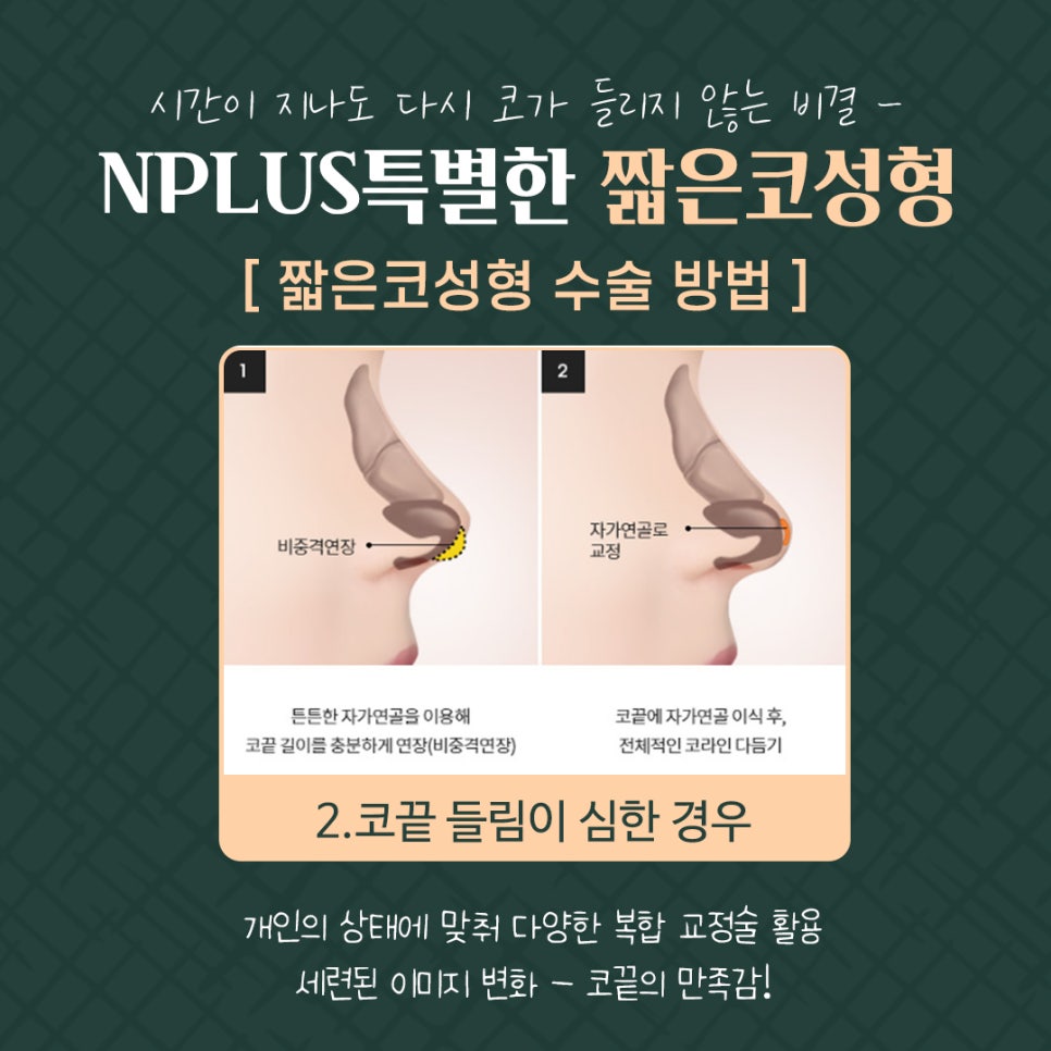 들린코수술로 이미지 개선 관련 이미지 10