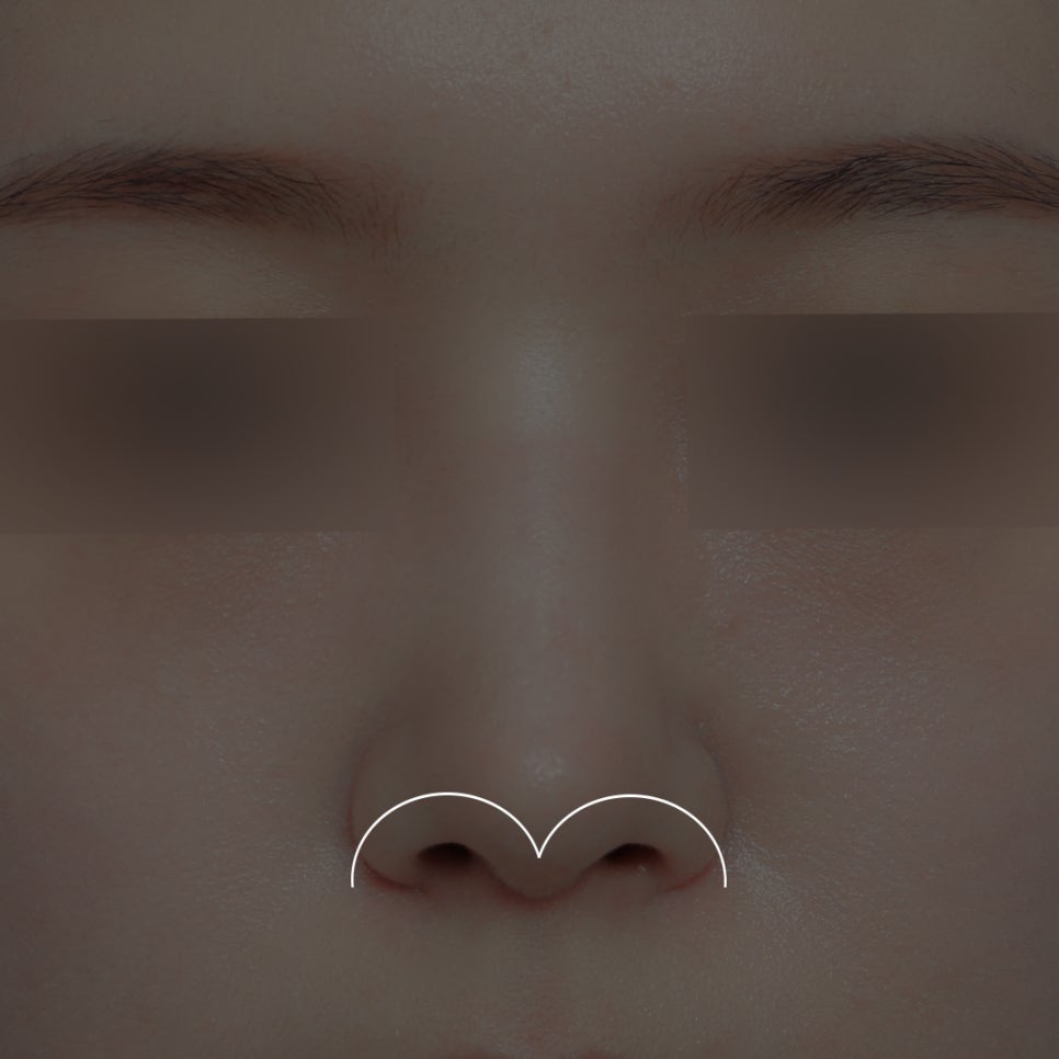 What Is the Prettiest Nose That Suits My Face Best? image 5