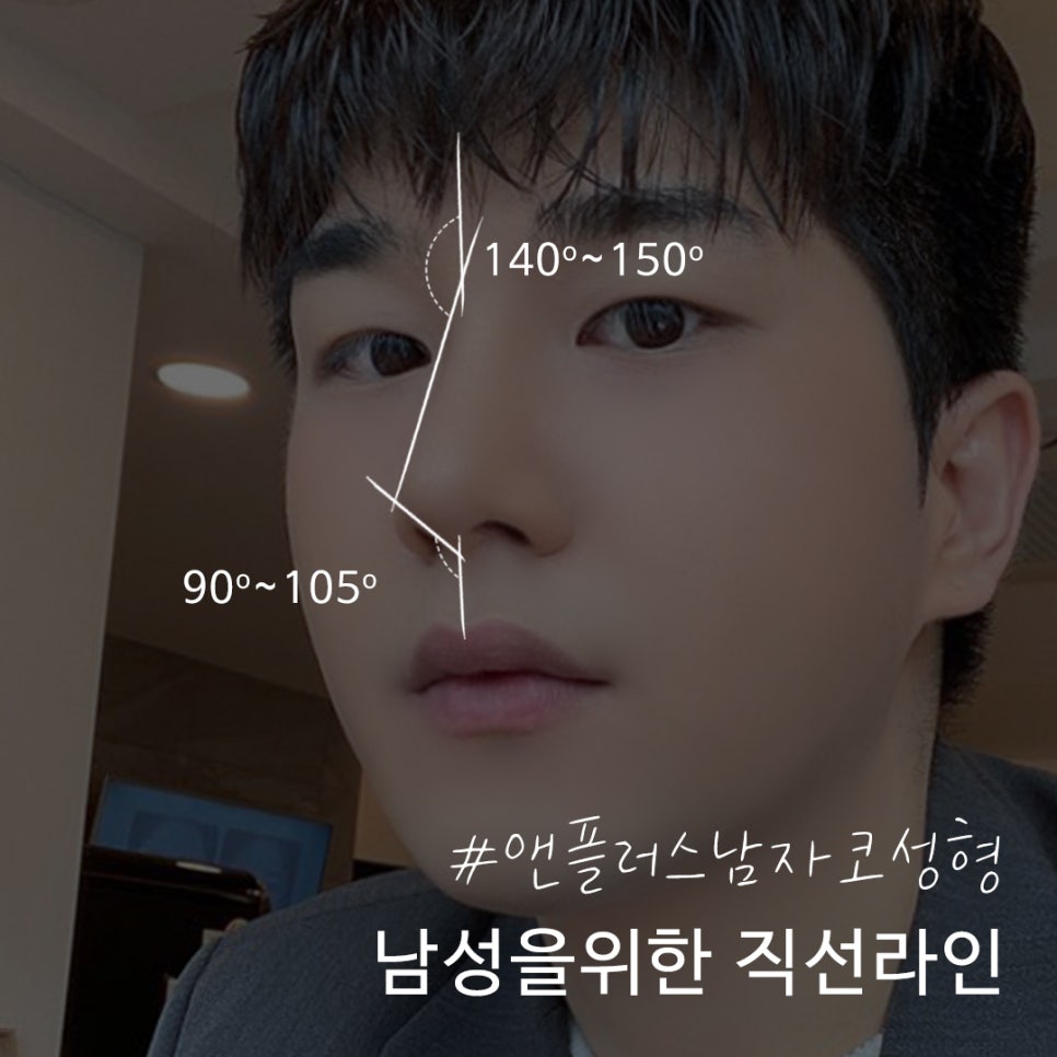 남자코성형 직선코라인으로 기능까지 확인하여 관련 이미지 3