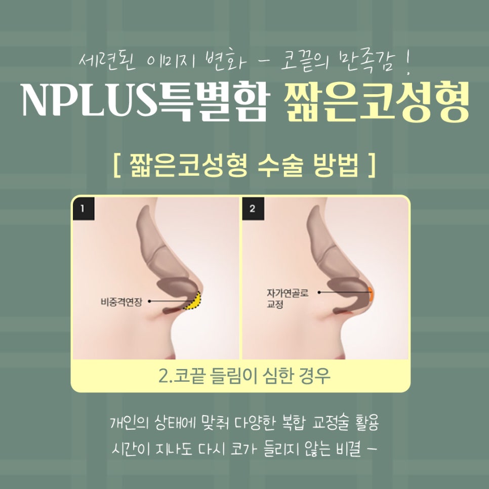 Considering the Line in Reviews of Low, Short Nose Surgery image 10