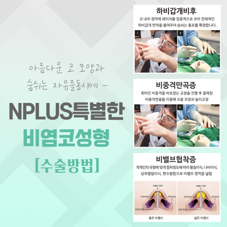 비염수술 내부 진단을 통해 관련 이미지 8