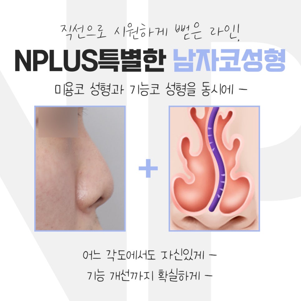 Looking into Male Nose Surgery Reviews in Detail image 4