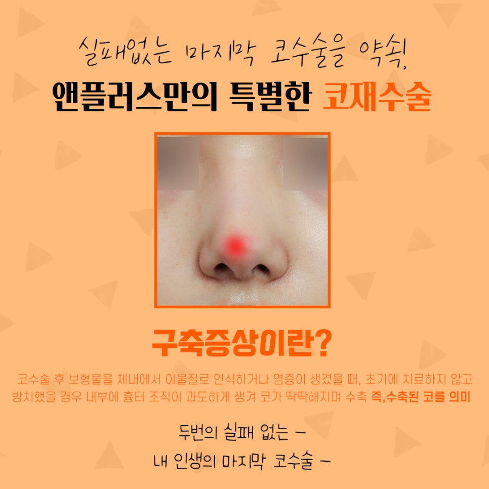 코재수술후기 자연스럽고 예쁘게 관련 이미지 4