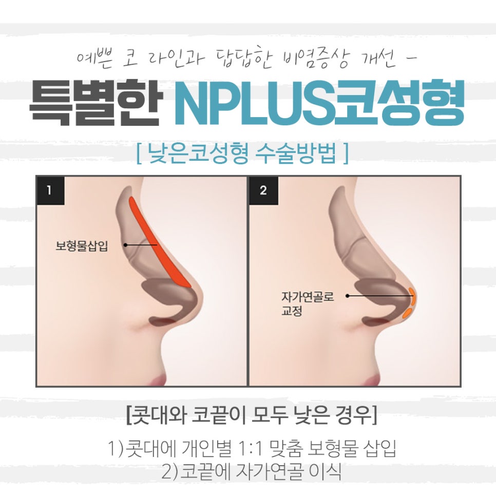 Reviewing Low Nose Surgery Reviews Carefully image 7