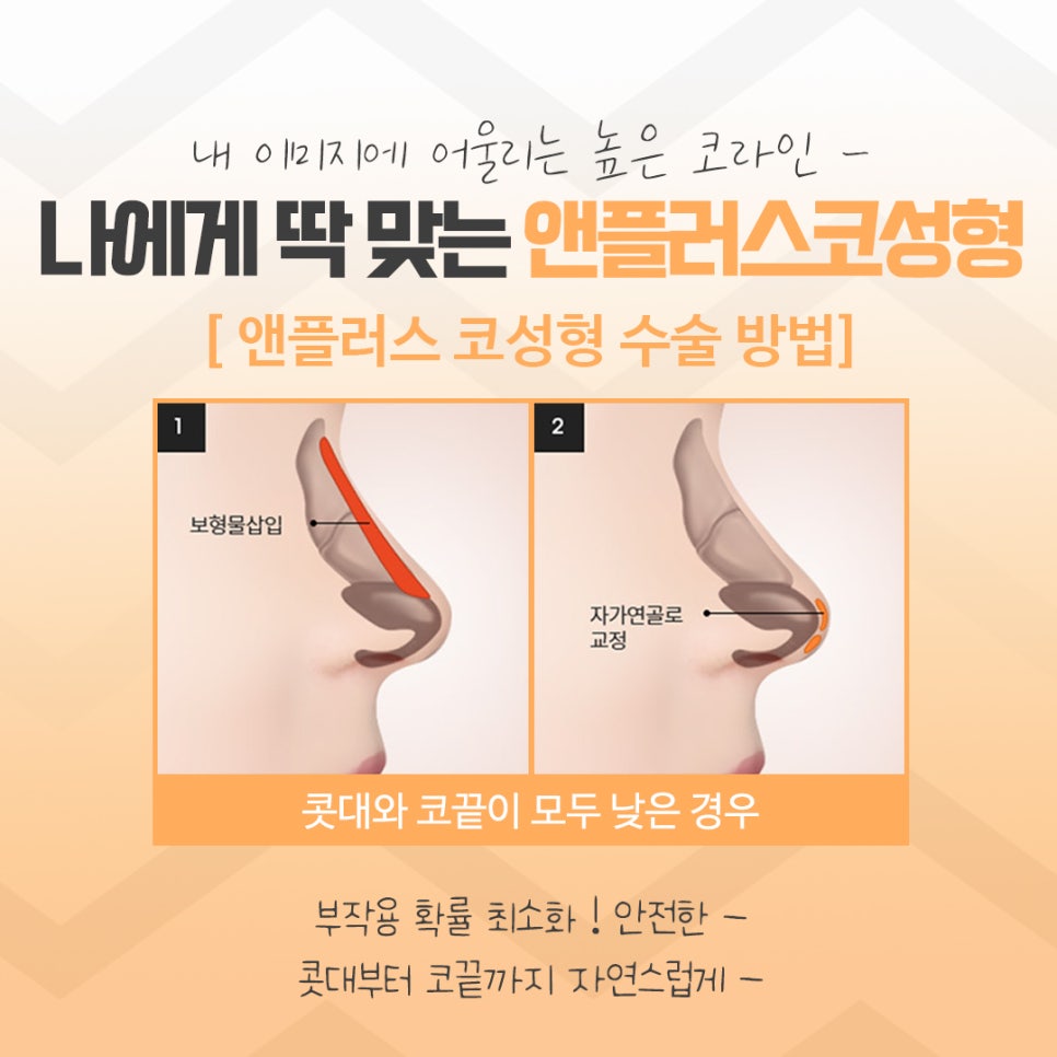 코수술후기에 대해 자세히 찾아보고 관련 이미지 8