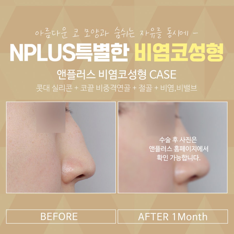 You Should Check the Rhinoplasty and Rhinitis Surgery Reviews Carefully Before Proceeding image 8