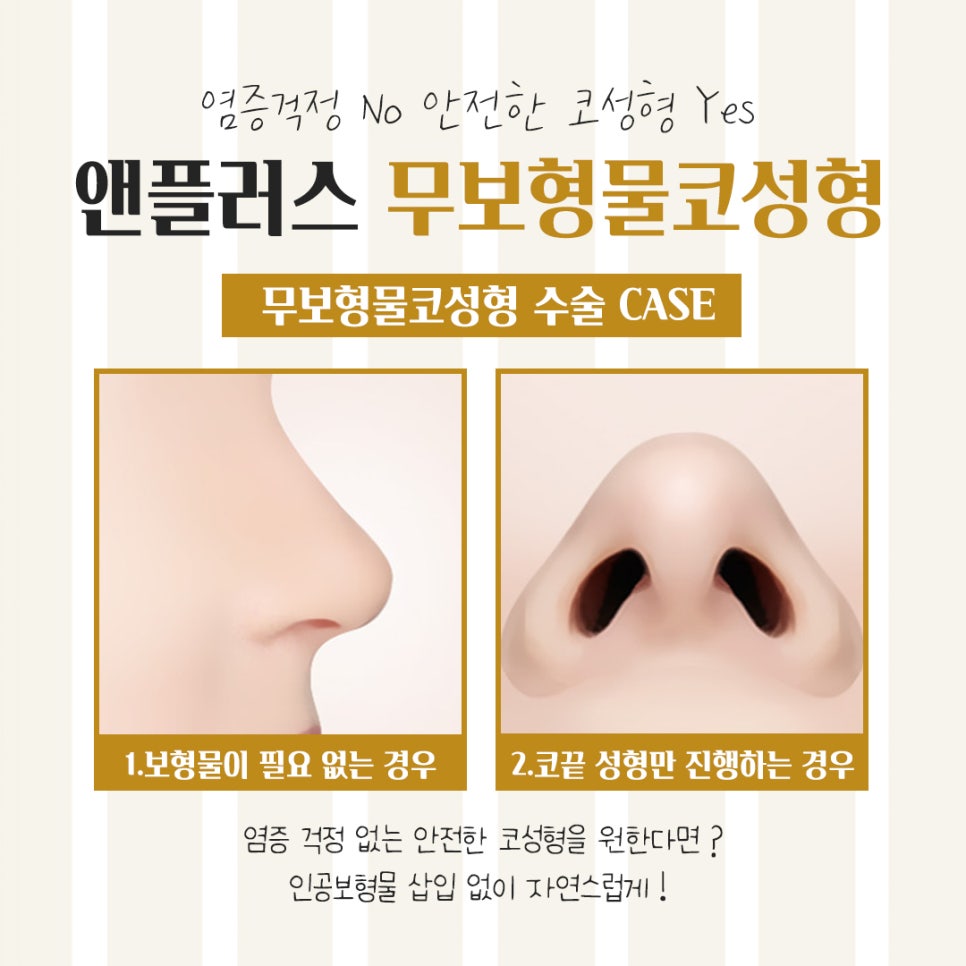 무보형물코수술후기 다양한 내용을 알아보고 관련 이미지 6
