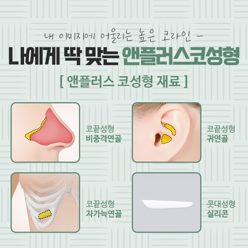 자가연골코수술로 세련되고 자연스럽게 관련 이미지 12