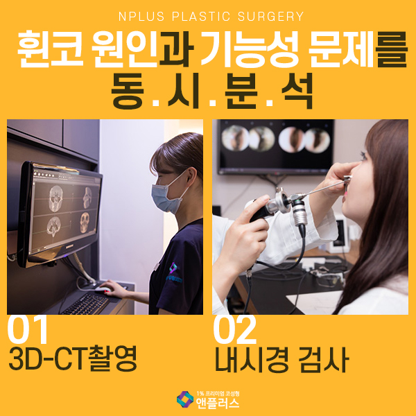 Crooked Nose Surgery at N+ image 5