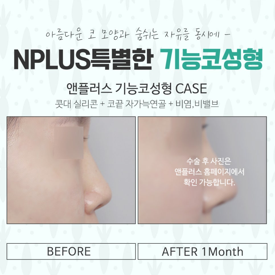 기능코수술후기 다양하게 고려하여 관련 이미지 14
